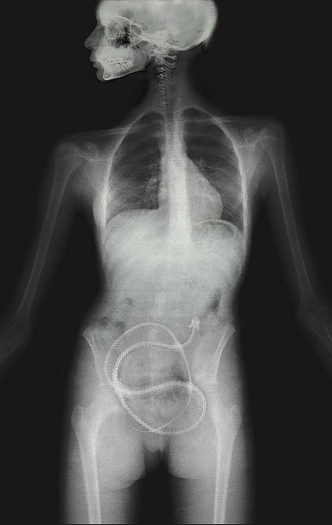 Snake X-Ray Soup X2 Snake X-Ray Soup X2